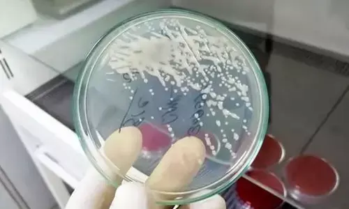 Why still an old diagnosis for UTIs?