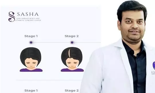 Hair Loss: Sasha Advanced Treatments To Stop Hair Loss and Boost Hair Growth