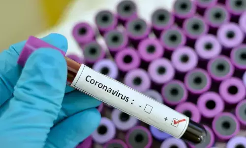 For representational purpose