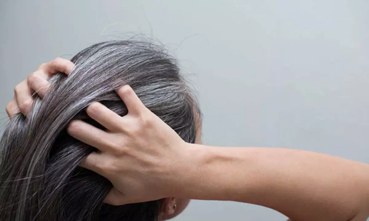 Best Home Remedies for Grey hair