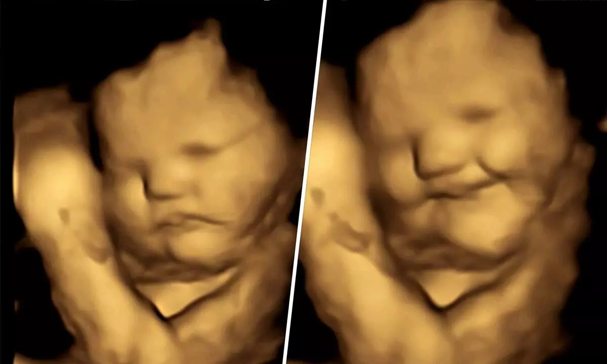 New Study reveal unborn babies smile and react to food flavours inside mother’s womb