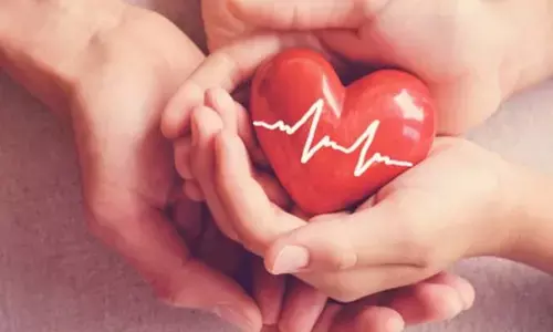 Representational image