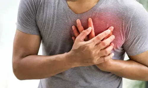 Representational image