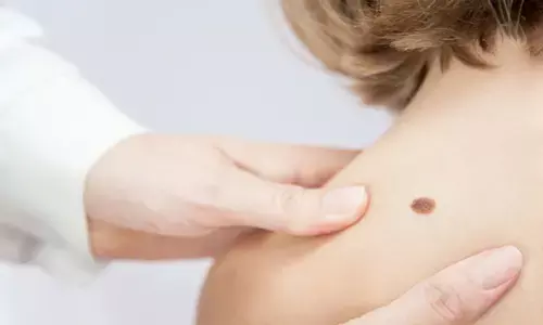 Representational image