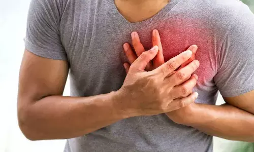 Representational image