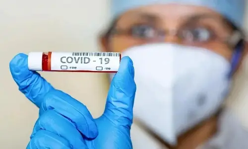 For representational purpose