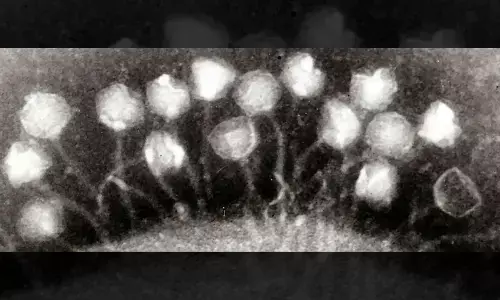 Bacteriophages on a bacterium. (Graham Beards/Wikimedia Commons/CC BY-SA 3.0)
