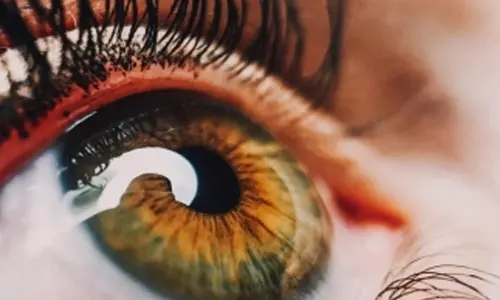 Health department on alert after fivefold increase in Conjunctivitis in Chennai