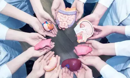 Representational image