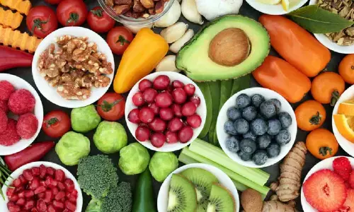 Representational image