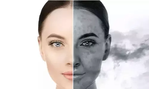 A guide to protect your skin from pollution