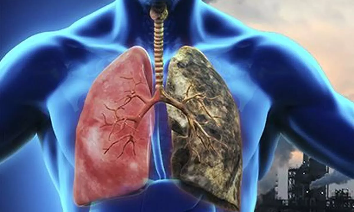Air pollution damage to lungs is irreversible