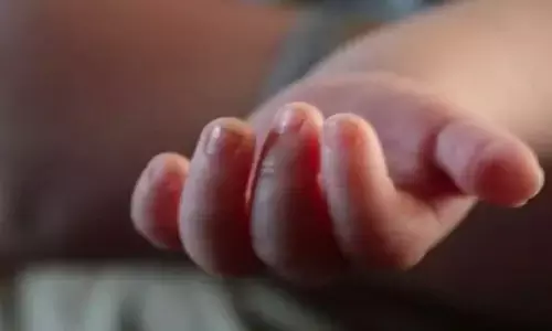 Representational image