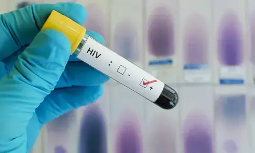 35% HIV patients in UP unaware of their health status