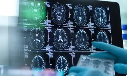 For representational purpose