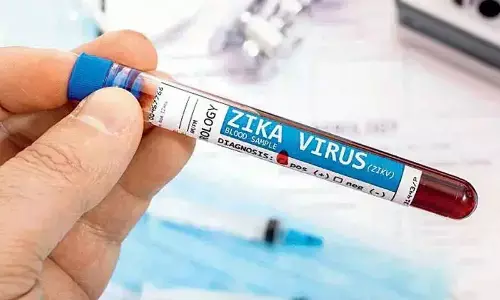 First zika virus case reported in Karnataka