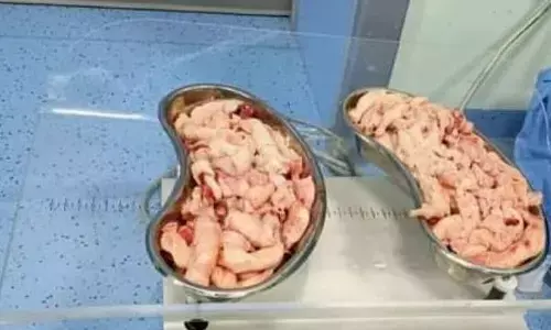 2-kg fibroid successfully removed with the help of surgery