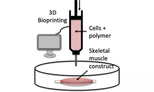 Students win award for creating model for type 2 diabetes