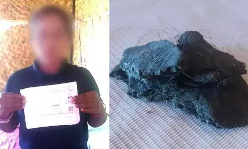 Telangana woman pastes M-Seal in hair to increase height for police job