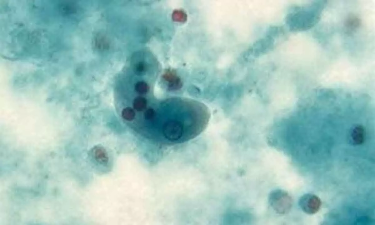 Naegleria Fowleri, an Brain eating Amoeba : First known infection leading to Death in South Korea