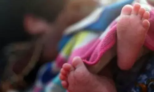 For representational purpose