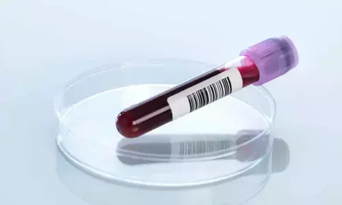 New test can detect Alzheimers neurodegeneration in blood