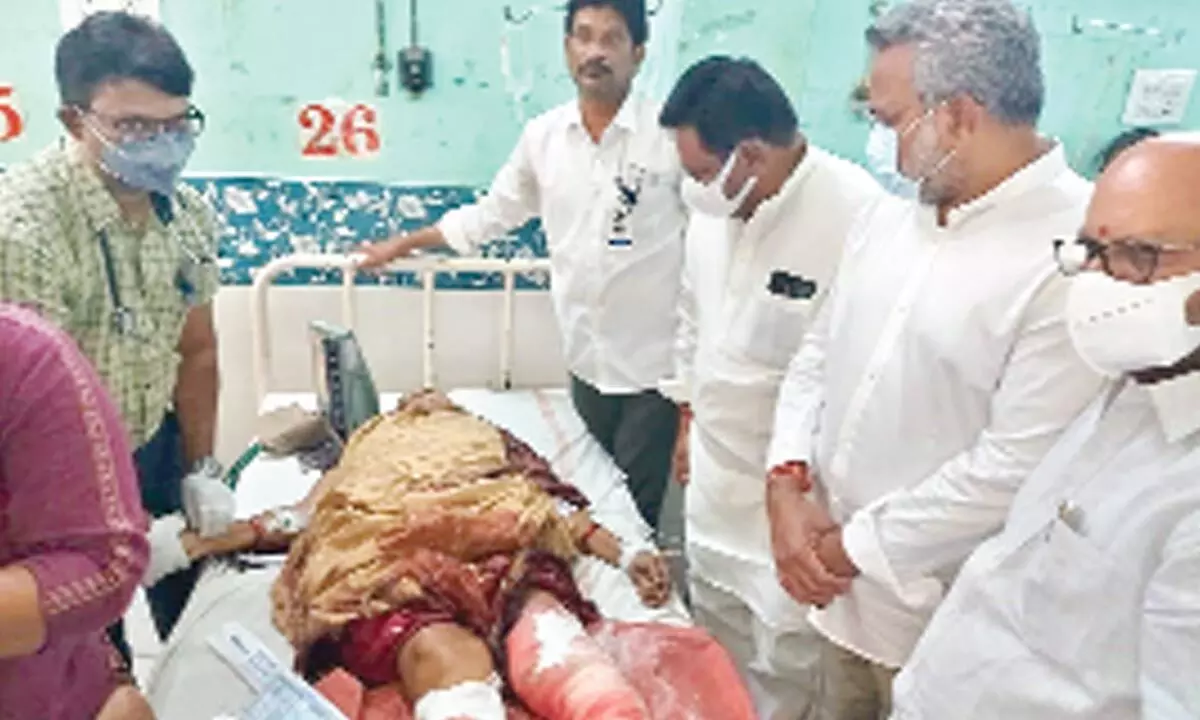 Senior TDP leader Nimmakayala Chinarajappa, former MLAs SVSN Varma and Kondababu consoling the injured woman at Government General Hospital in Kakinada on Tuesday