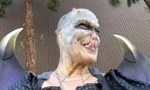 Tiamat Eva Medusa has undergone extreme body modifications.