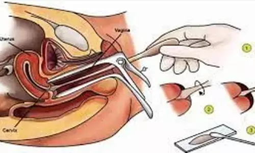 Free PAP smear test from Jan 23 at Aster RV hospital