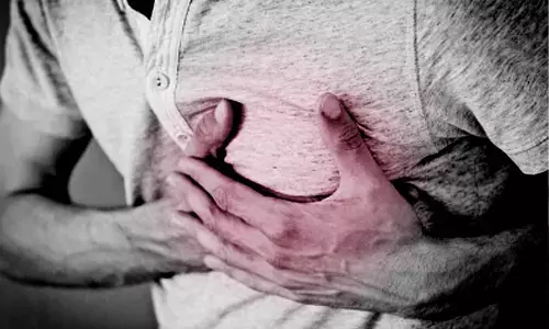 For representational purpose