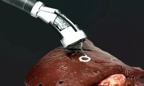 New robotic arm to 3D bioprint directly on organs inside human body