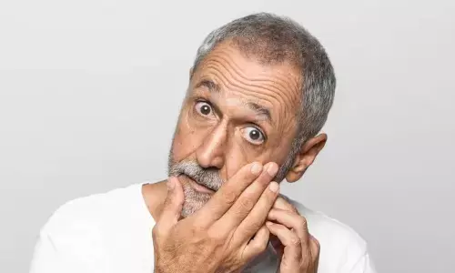 Debunking top 5 glaucoma myths