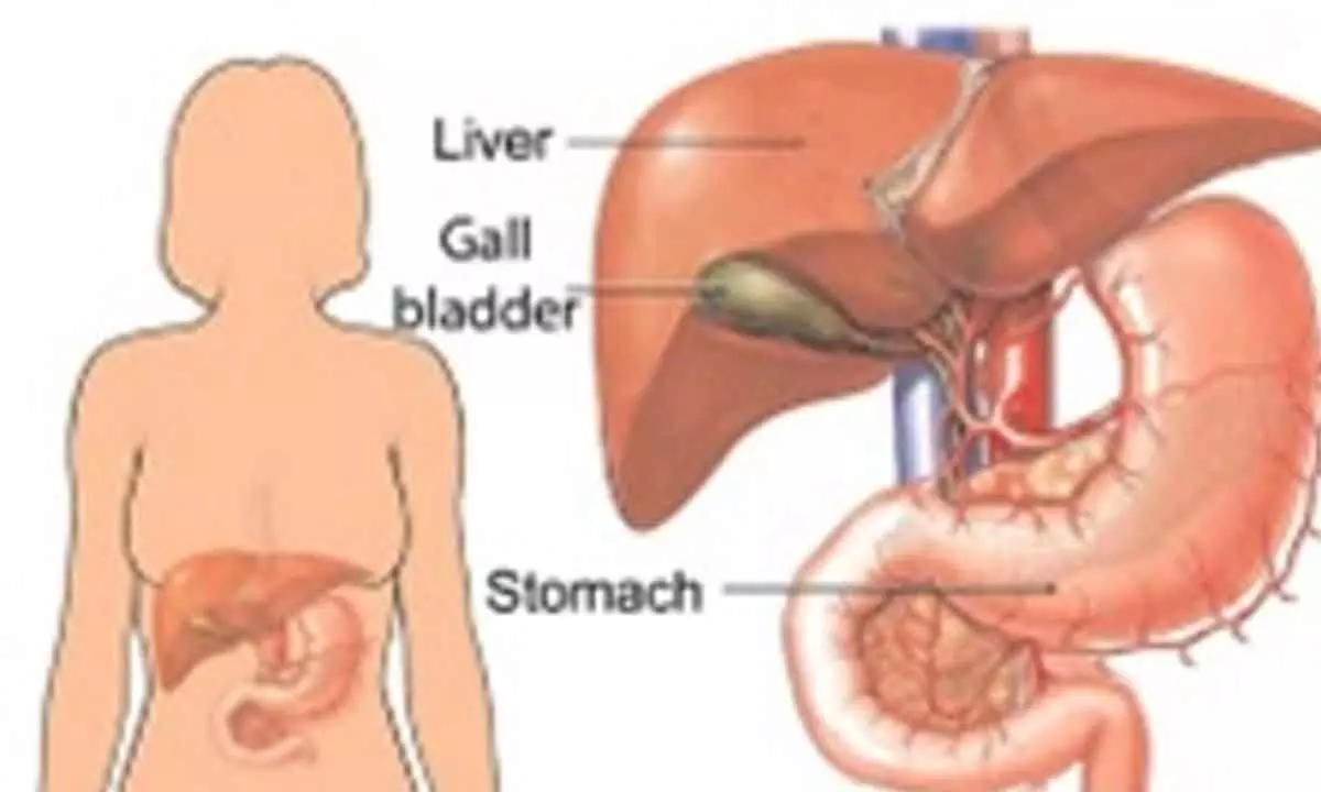 Gal bladder stones can mimic gastritis