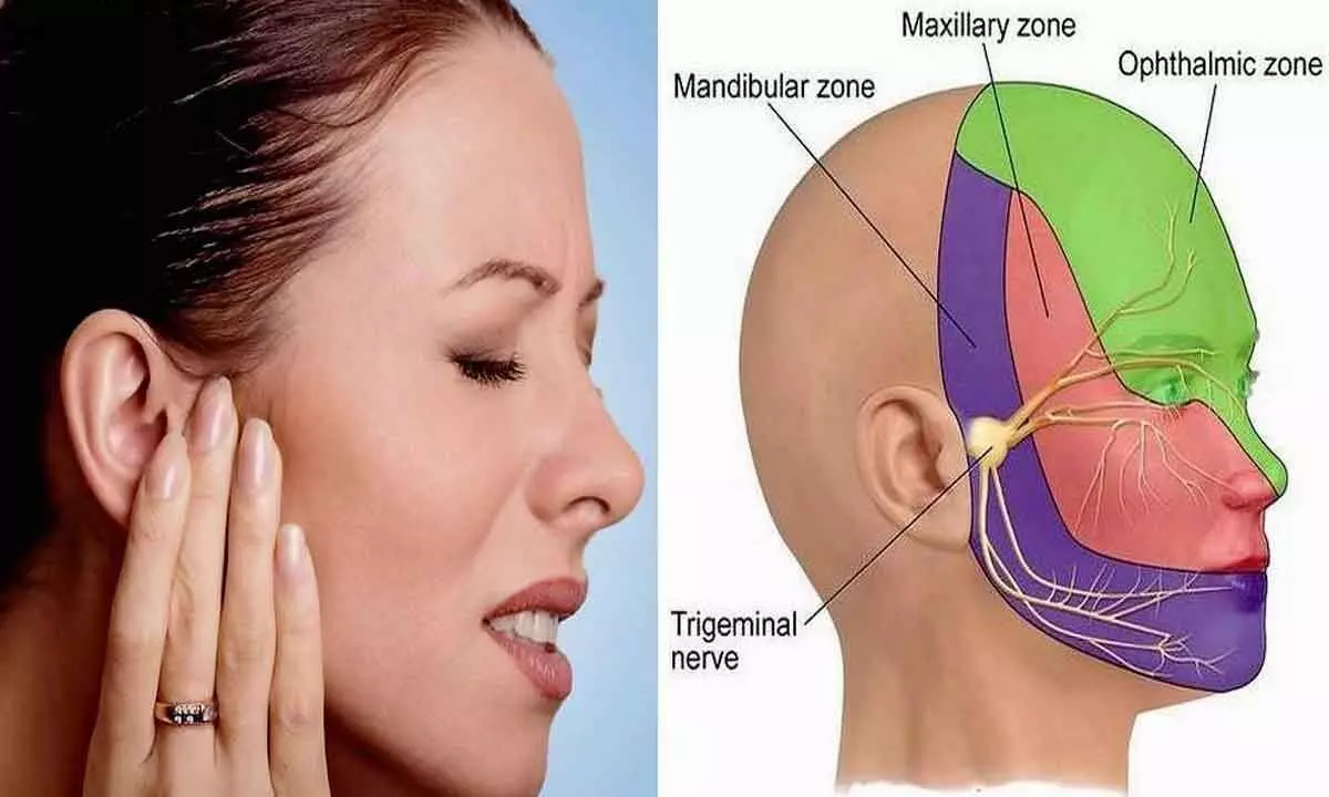 Your Facial Pain might be A Trigeminal Neuralgia