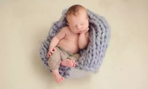 Representational image