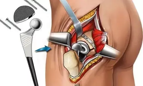 Fresh lease of life for bedridden resident after marathon hip reconstructive surgery