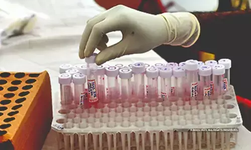 Delhi logs 139 fresh Covid-19 cases