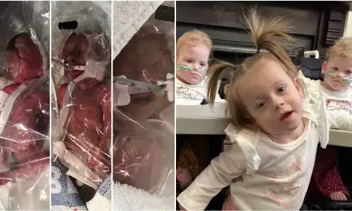 Babies From UK Set New Guinness World Record For Being The Most Premature Triplets