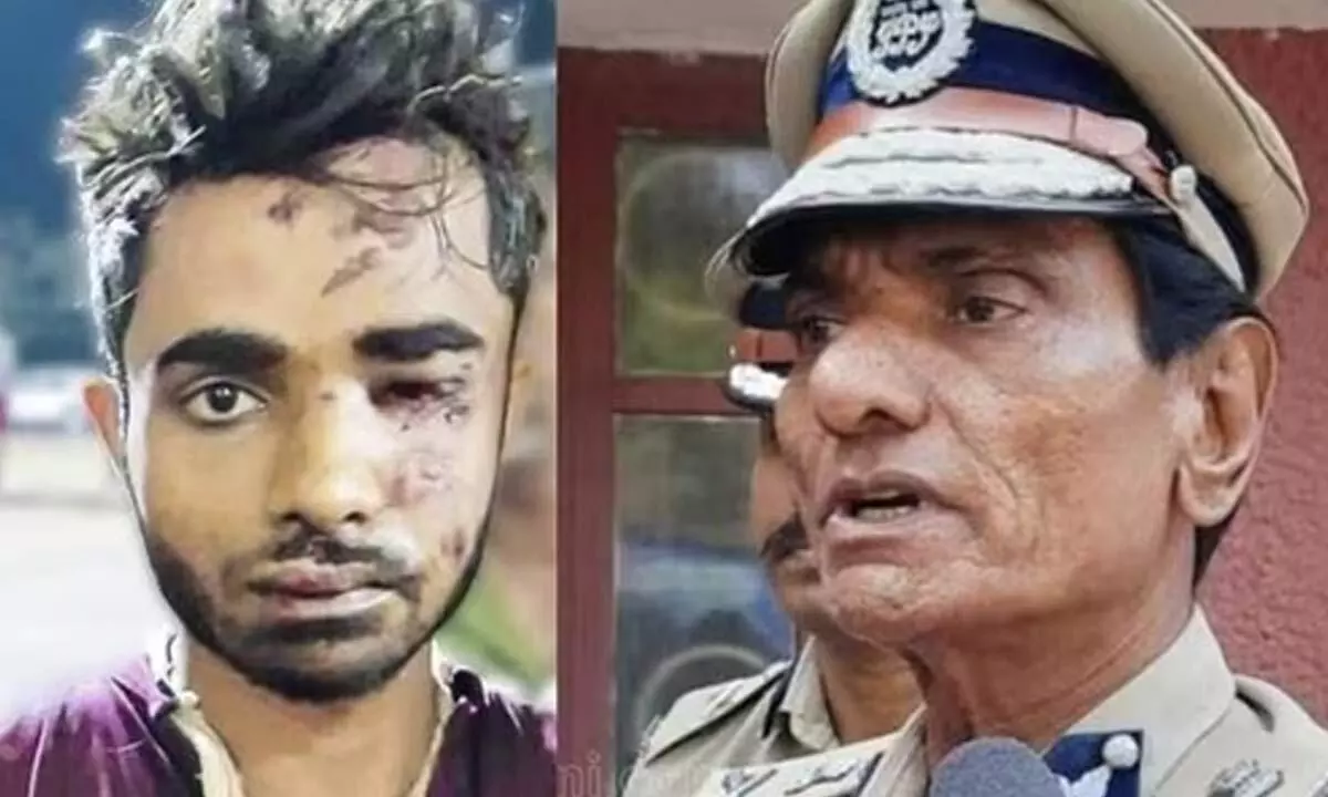 Suspect Responsible For Train Fire In Kerala Got Caught And Is Undergoing Medical Examination