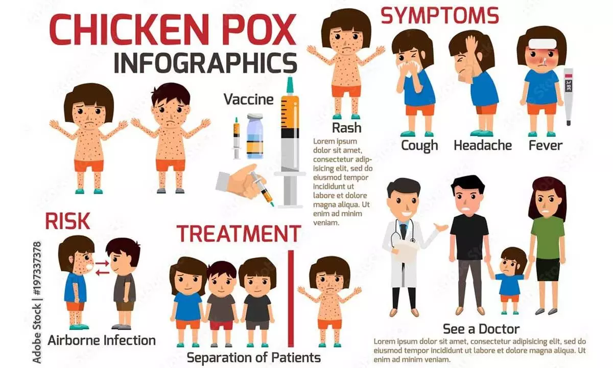 City sees uptick in chickenpox cases among school children
