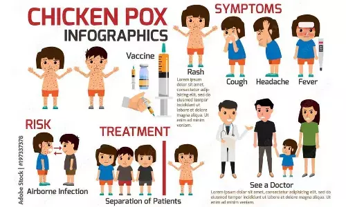 City sees uptick in chickenpox cases among school children