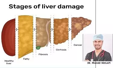 Let your liver live long