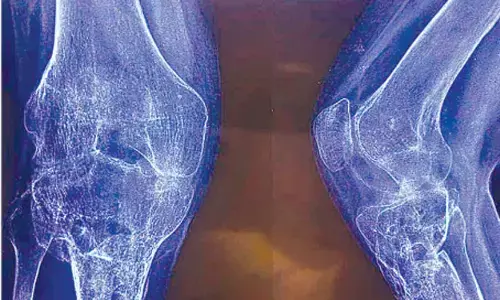 30-yr-old wheelchair bound gym trainer regains mobility 3yrs after surgery