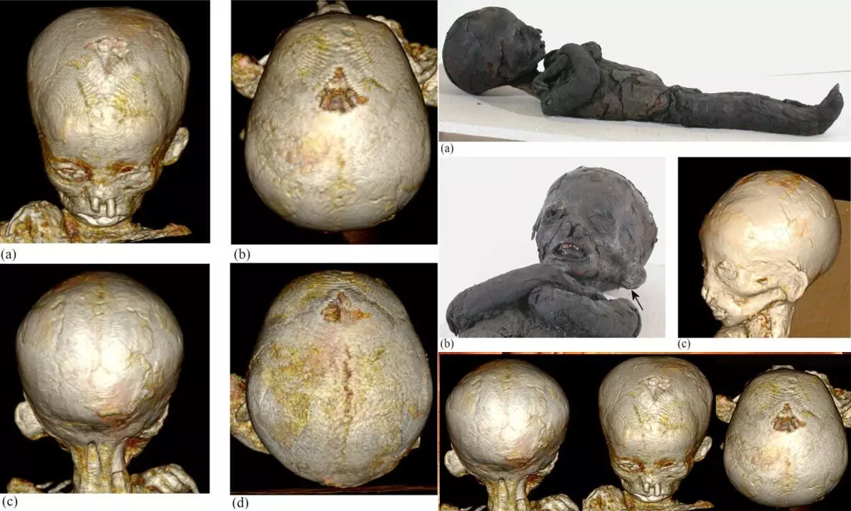 3D reconstruction of the skull of one of the children. (Panzer et al., International Journal of Osteoarchaeology, 2023)