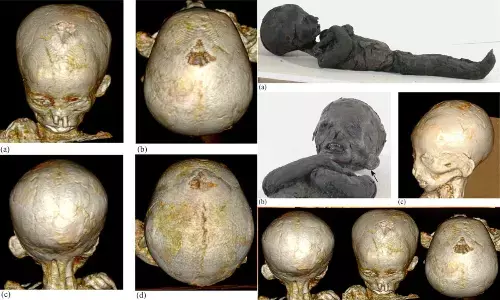 3D reconstruction of the skull of one of the children. (Panzer et al., International Journal of Osteoarchaeology, 2023)
