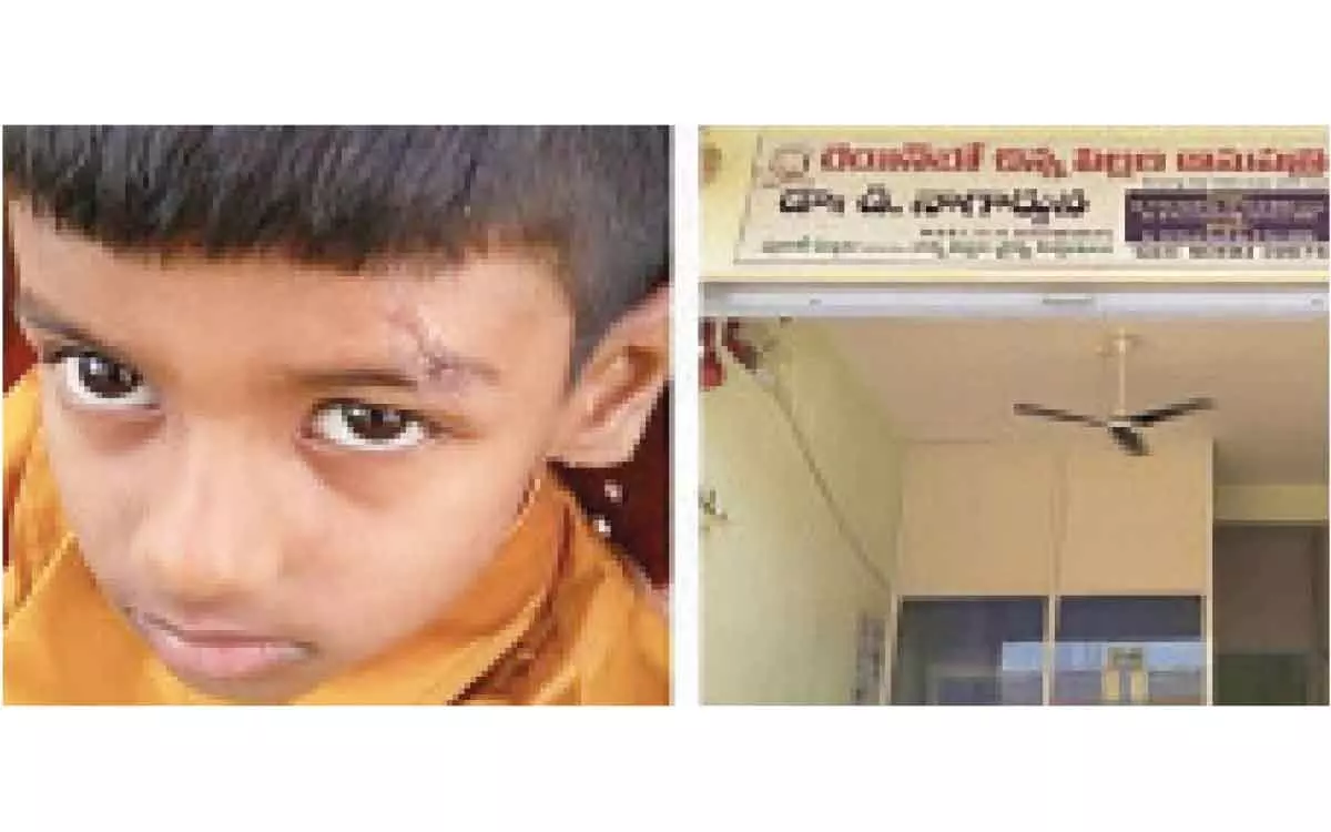 Gadwal: Doctor applies feviquick on wounds of 7-year old