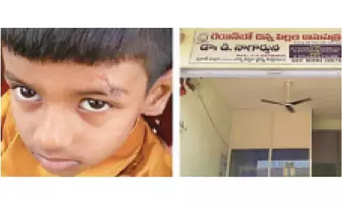 Gadwal: Doctor applies feviquick on wounds of 7-year old
