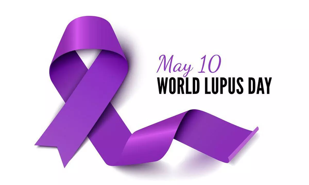 Are You Aware of This Masquerading Illness – ‘Lupus’?