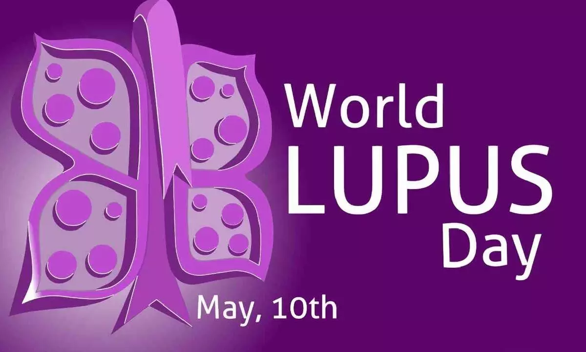 World Lupus Day 2023 Know its symptoms and significance of this day
