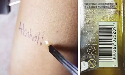 Agra-based businessman diagnosed and treated for alcohol allergy